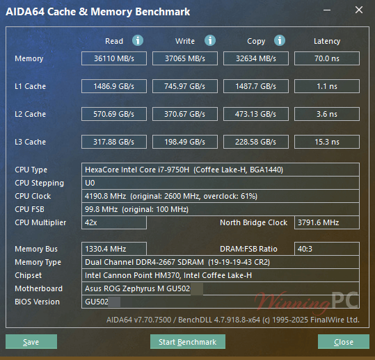 aida64 extreme cache and memory benchmark
